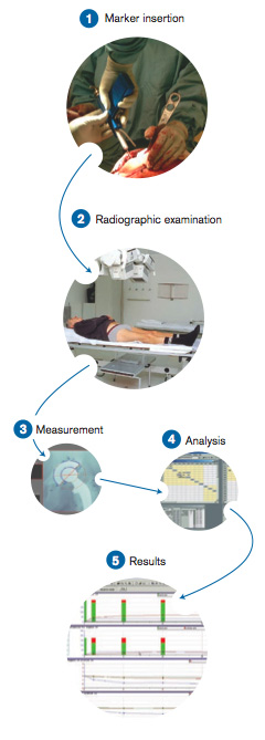 The RSA Method